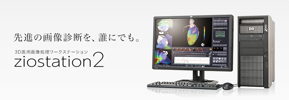 3D医用画像処理ワークステーションziostation2