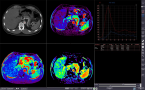 CT血流解析2のキャプチャー画像